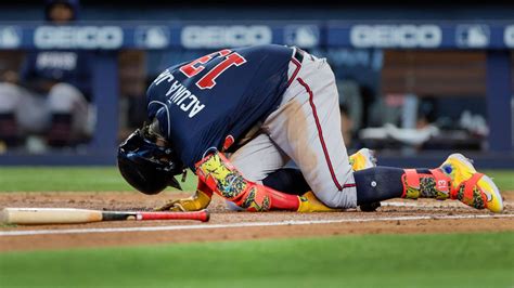 Braves star Acuña Jr. exits after fouling ball off left leg